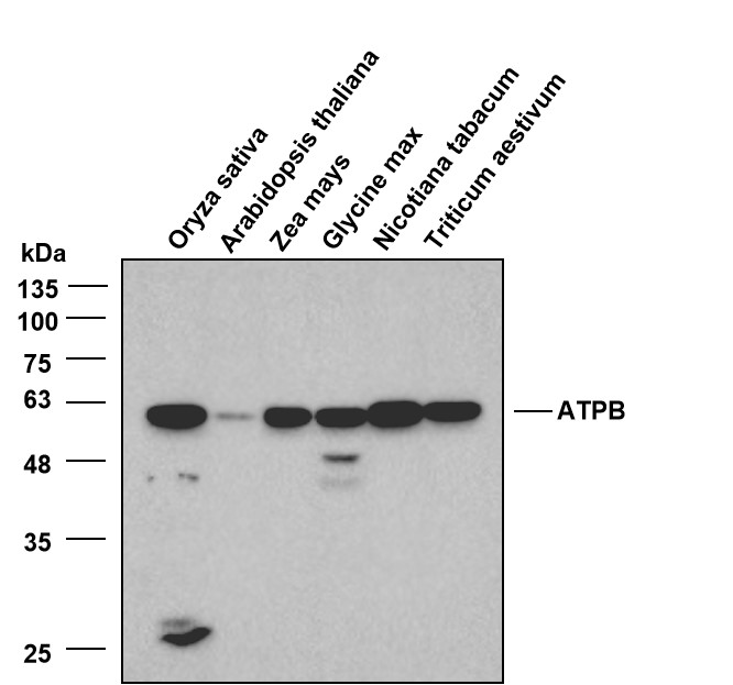 Anti-ATPB Monoclonal Antibody 