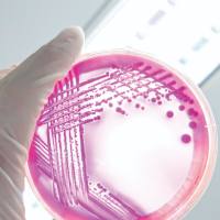 微生物研究实用工具与高通量解决方案