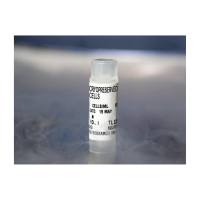 LONZA  CC-2540  正常人支气管/气管上皮细胞 单个供体