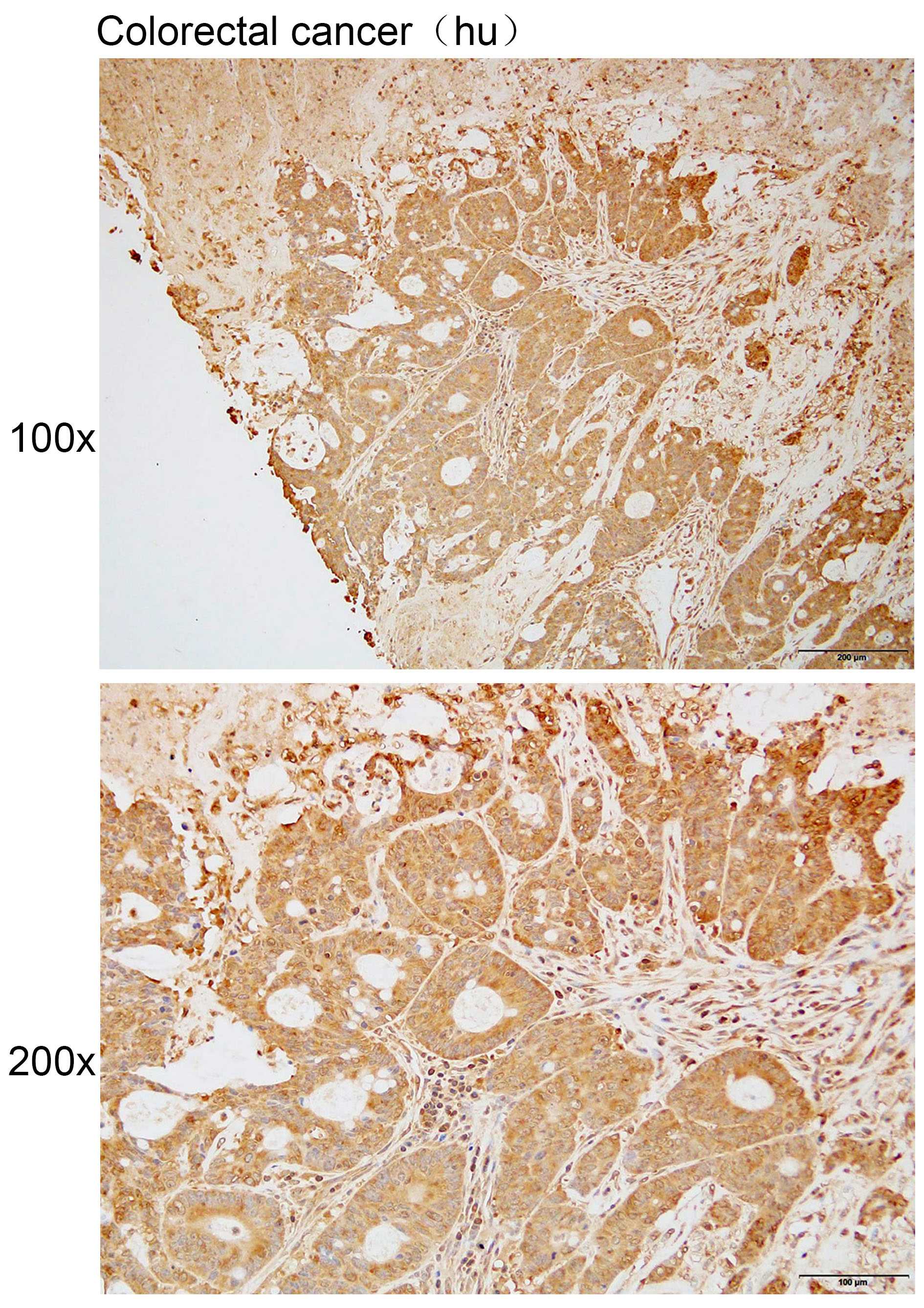 Anti-B4GALT4 Polyclonal Antibo