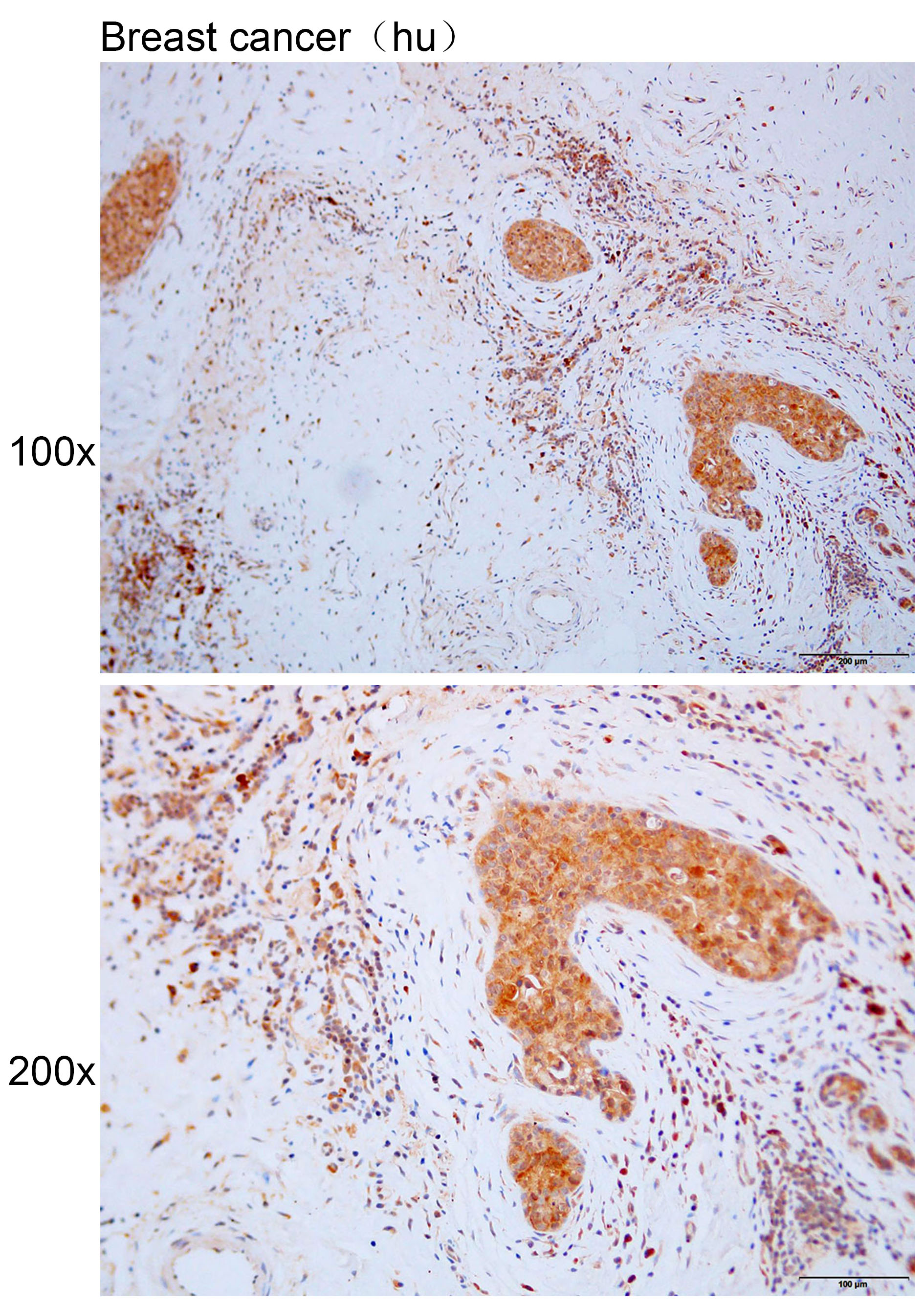 Anti-BBS5 Polyclonal Antibody