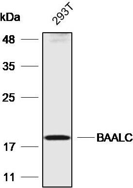 Anti-BAALC Polyclonal Antibody