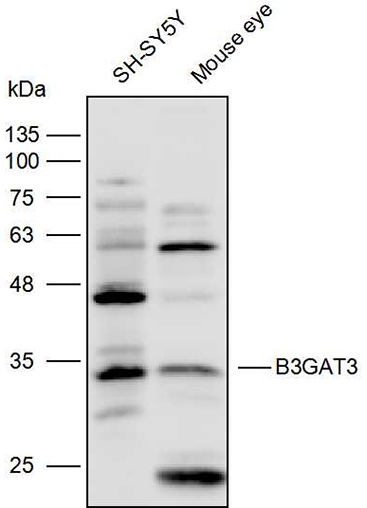 Anti-B3GAT3 Polyclonal Antibod