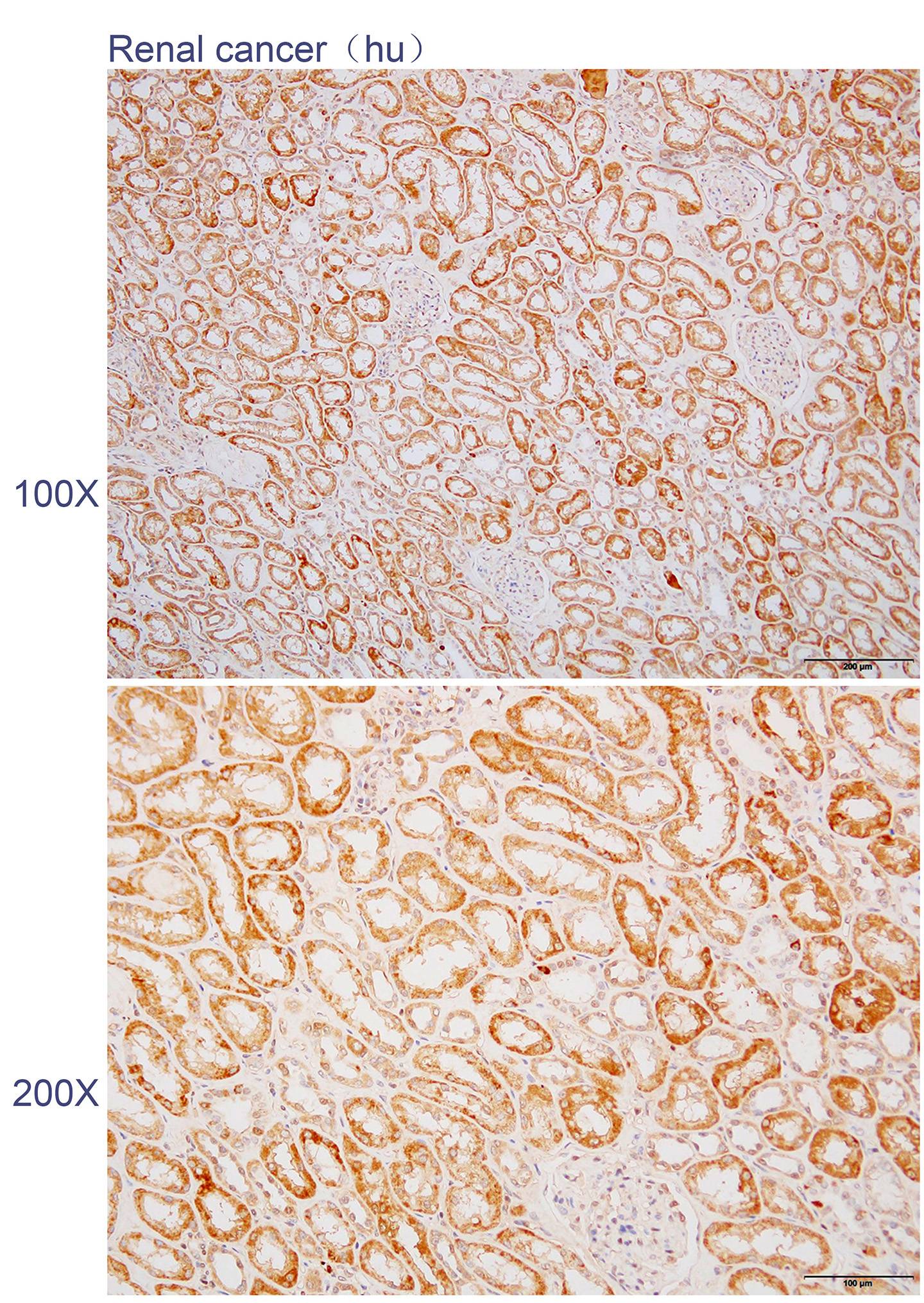 Anti-B4GALNT1 Polyclonal Antib