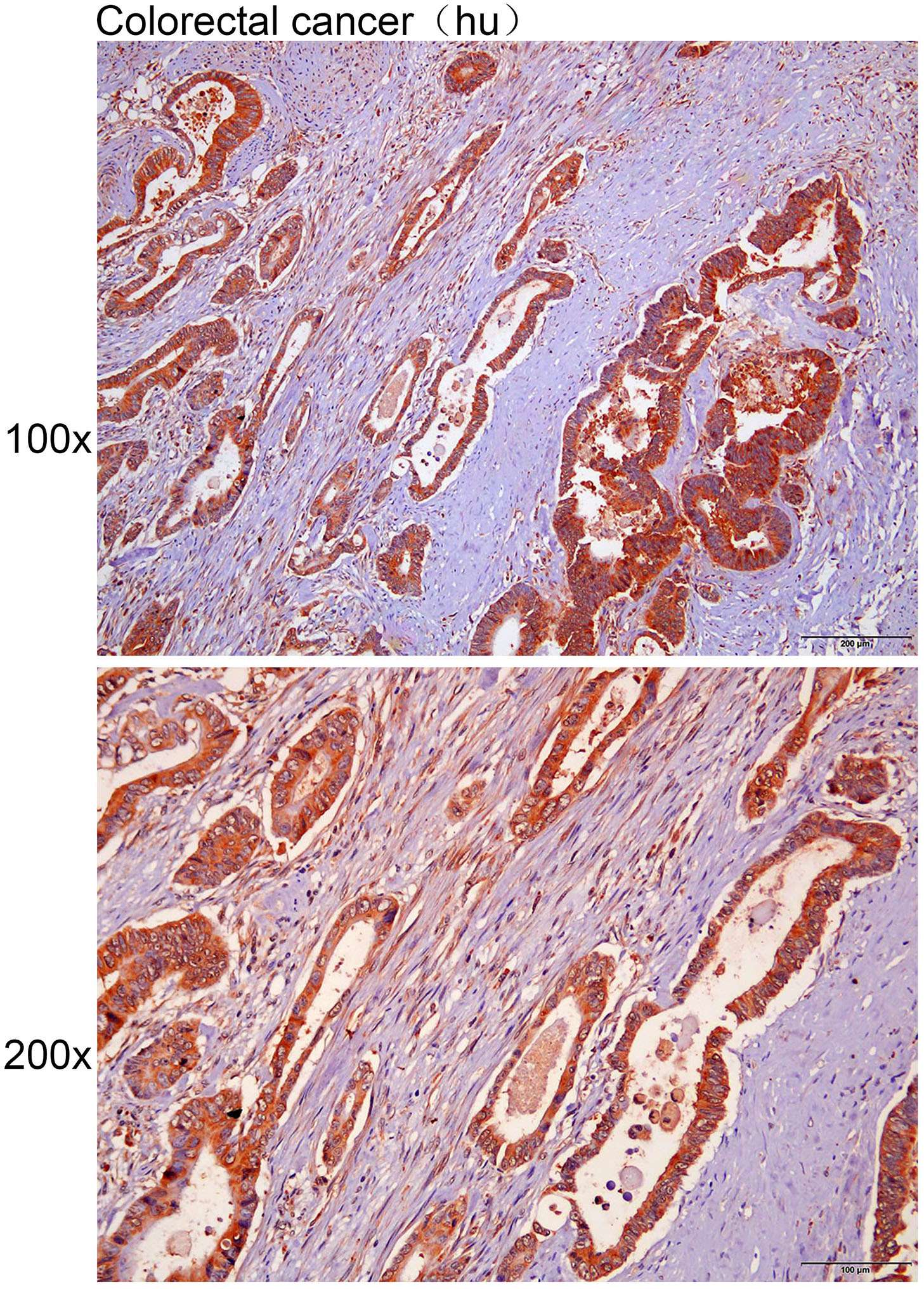 Anti-B2M Polyclonal Antibody