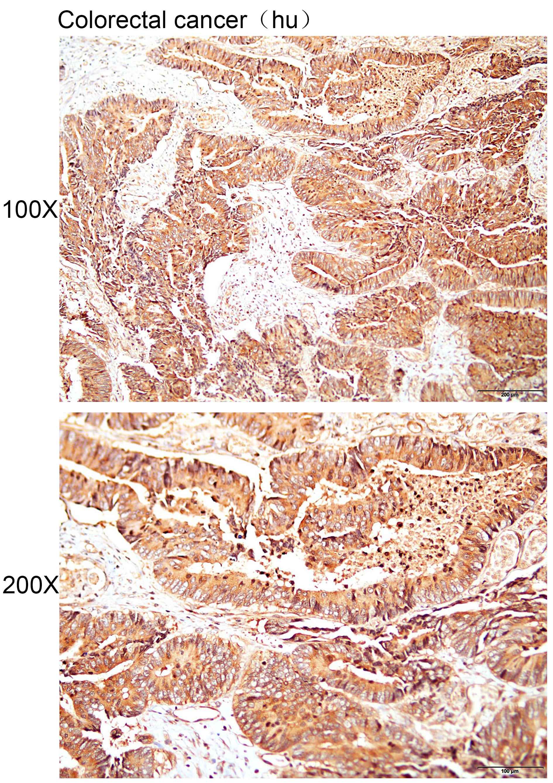 Anti-BNIP1 Polyclonal Antibody
