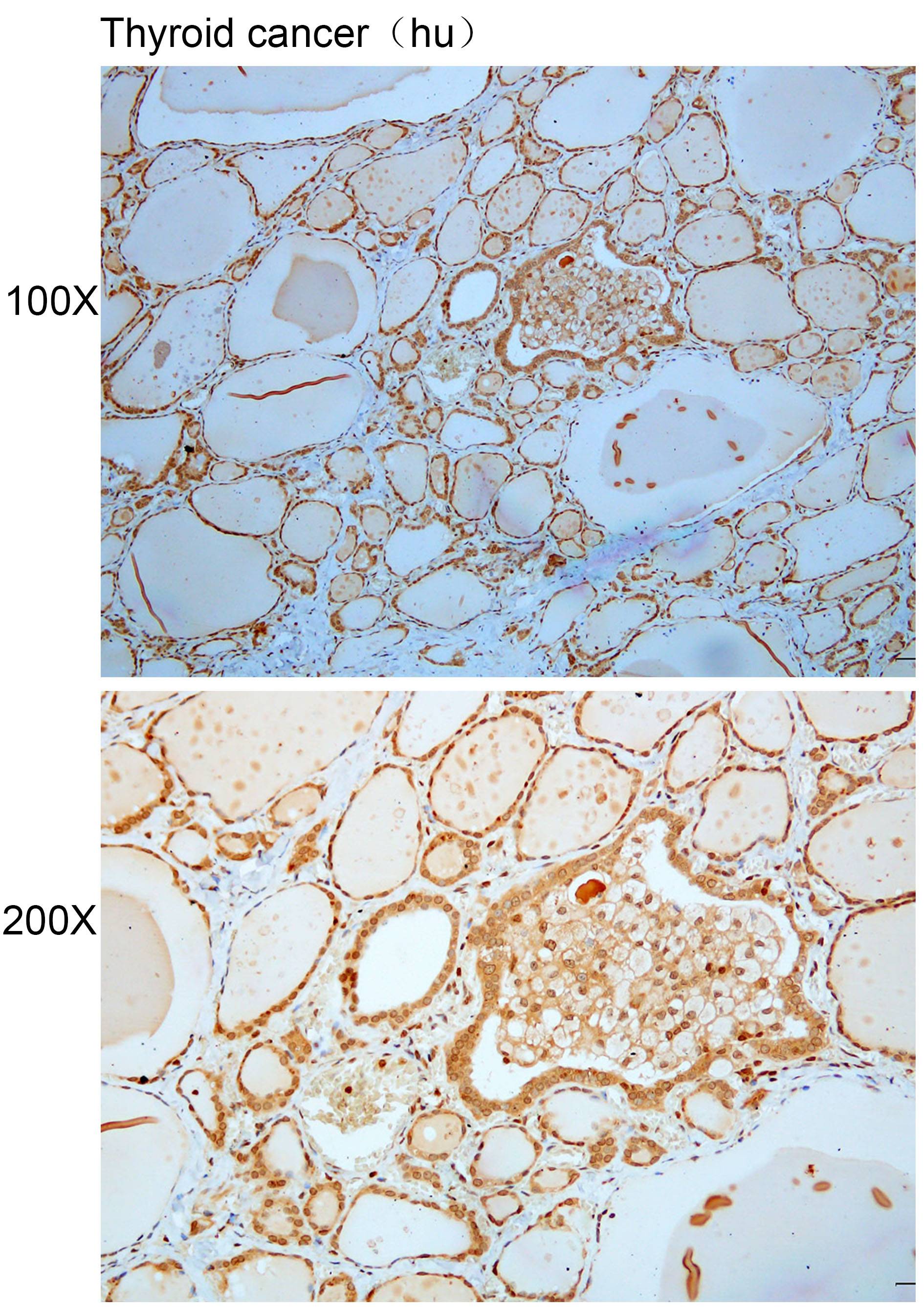 Anti-BRCA2 Polyclonal Antibody