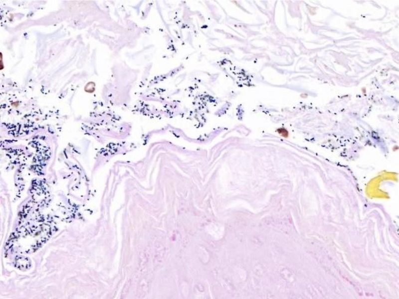 检测实验丨革兰氏染色实验