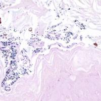 检测实验丨革兰氏染色实验