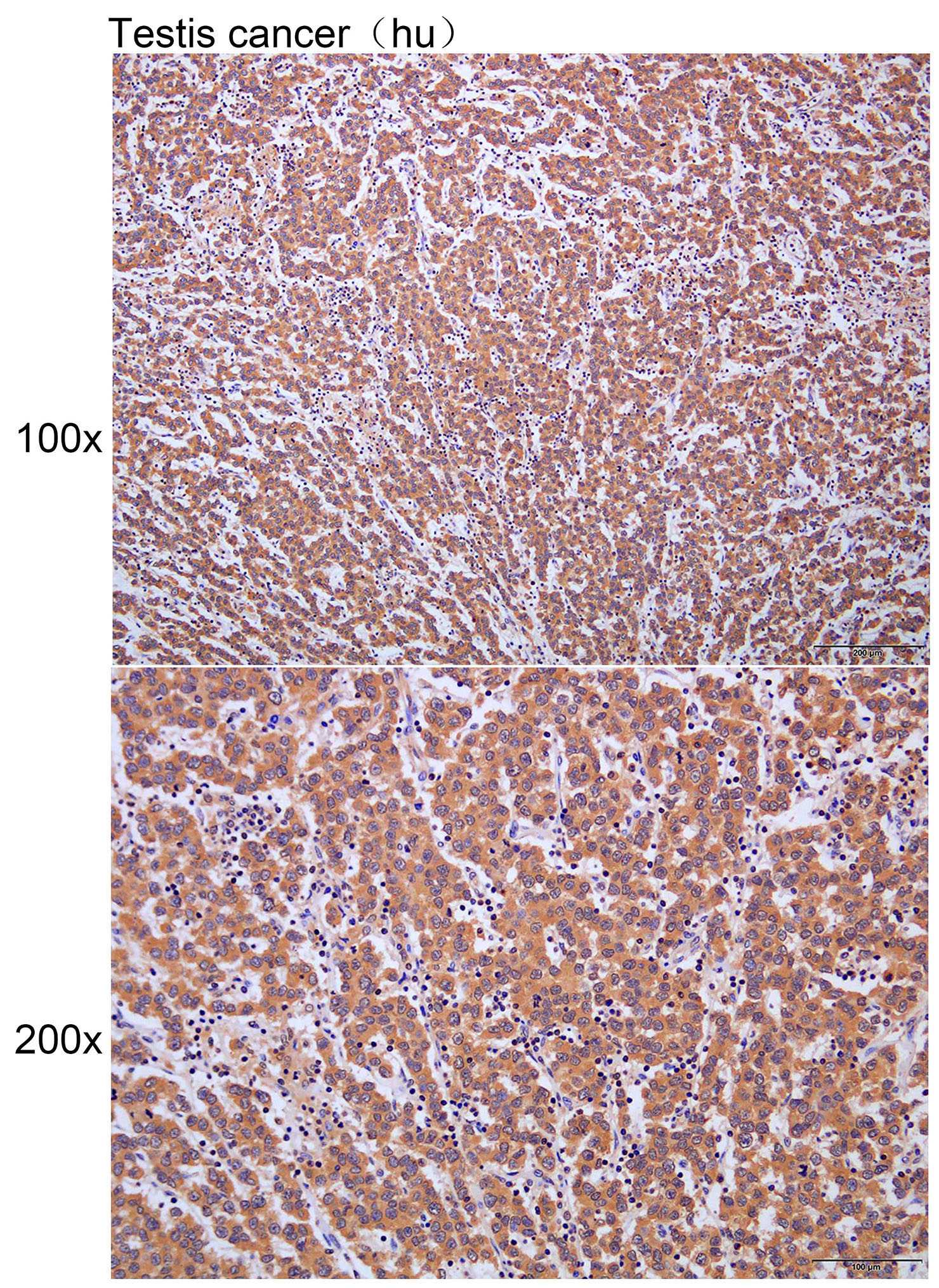 Anti-BMPR2 Polyclonal Antibody