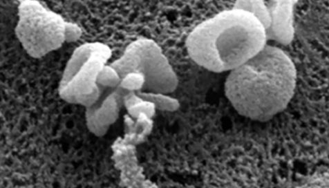 外泌体研究解决方案