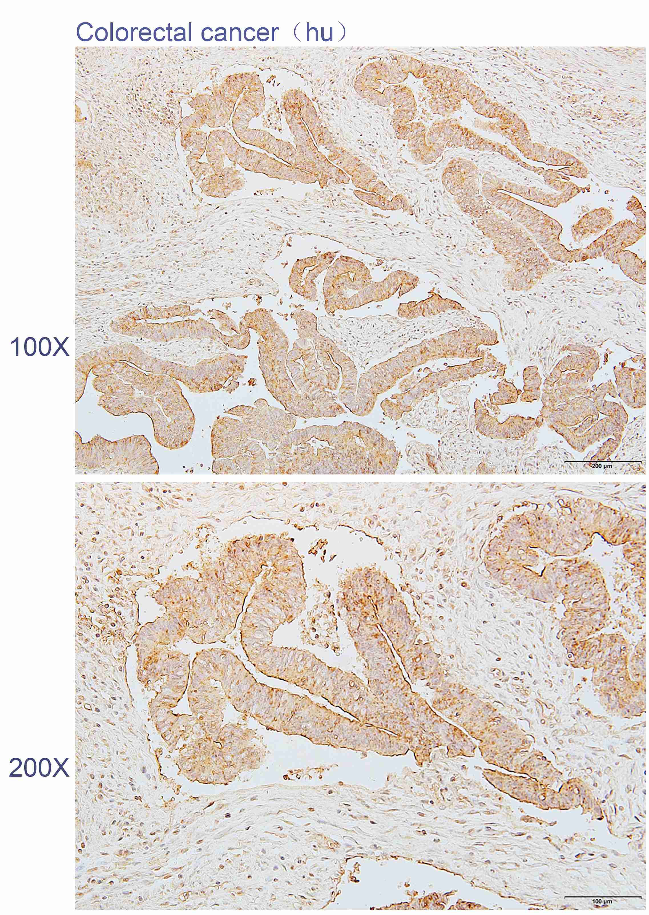 Anti-BEGAIN Polyclonal Antibod