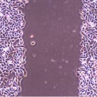 检测实验丨细胞划痕实验