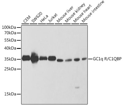 Anti-C1QBP Polyclonal Antibody