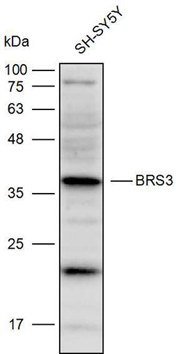 Anti-BRS3 Polyclonal Antibody