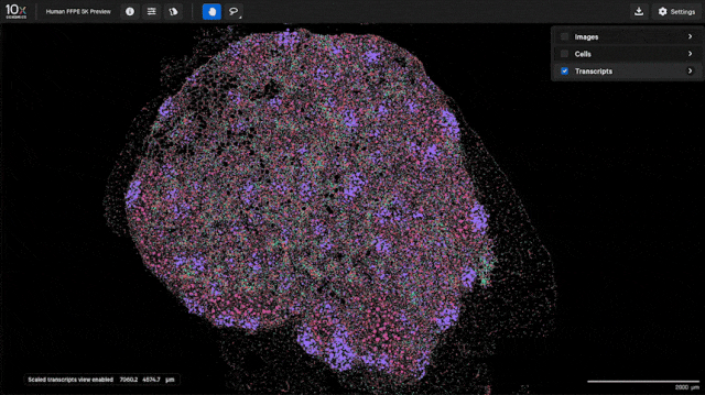 突破!10x Genomics Xenium技术实现基因原位检测新高度,空间生物学文章大爆发? - 企业动态 - 丁香通