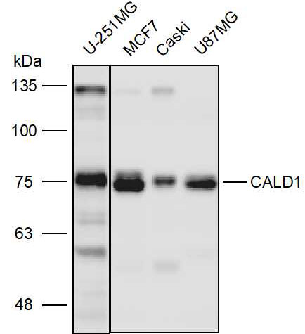 Anti-CALD1 Polyclonal Antibody