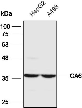 Anti-CA6 Polyclonal Antibody