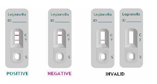  隧道内工人施工感染军团菌诊断试剂盒
