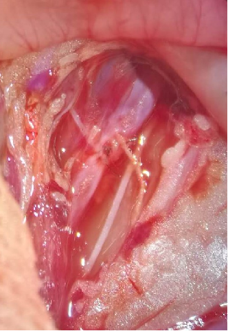 大小鼠肺动脉高压模型