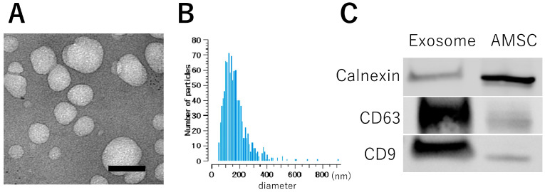 前沿速递:鼻内给药外泌体可减轻缺氧缺血性脑损伤