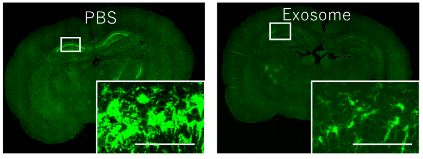 前沿速递:鼻内给药外泌体可减轻缺氧缺血性脑损伤