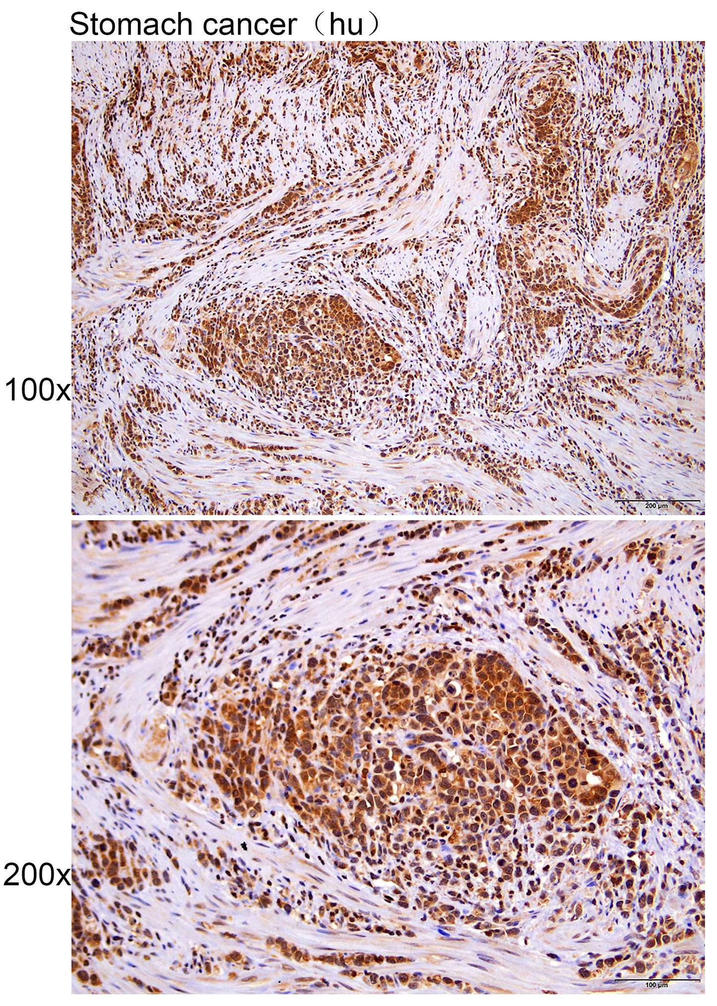 Anti-CASP1 (p20,Cleaved-Asn120