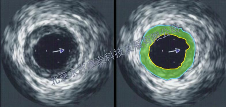 С������������Ӳ��ģ��