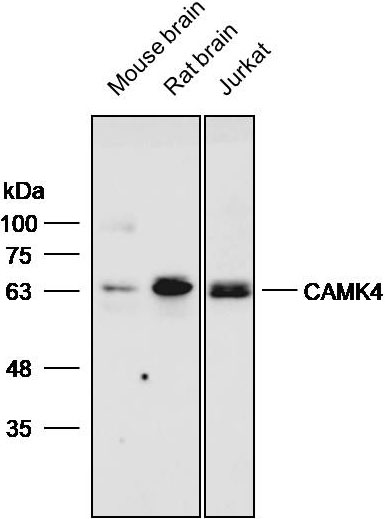 Anti-CAMK4 Polyclonal Antibody