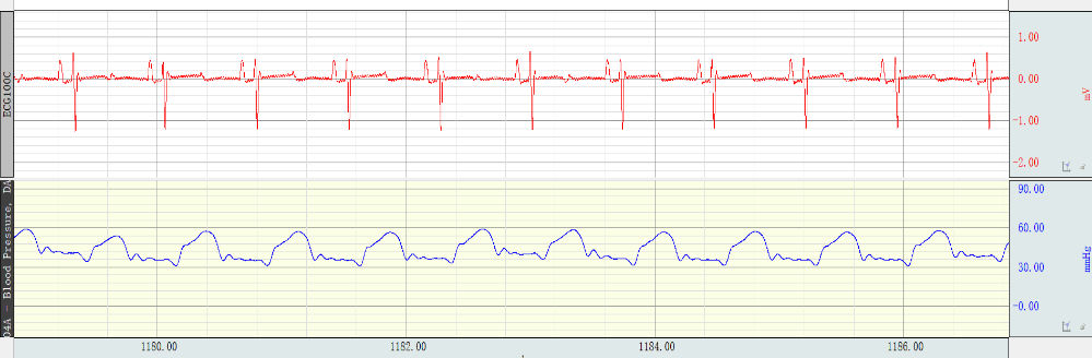 С�����ζ�����ѹģ��