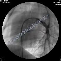 С�����ζ�����ѹģ��