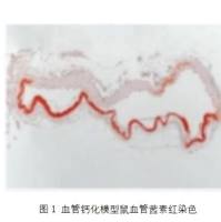 血管钙化（Vascular Calcification Model）模型