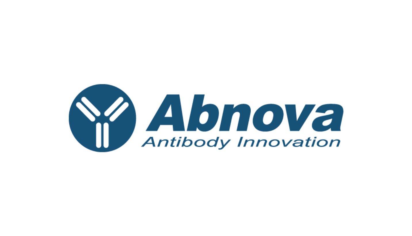 Abnova--打破传统蛋白抗体合成方式，安全性更强，应用更广_曼博生物 