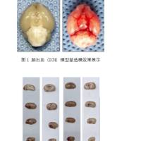 脑出血(ICH)模型