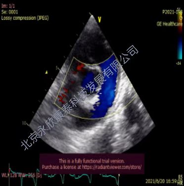 С�����ζ�����ѹģ��