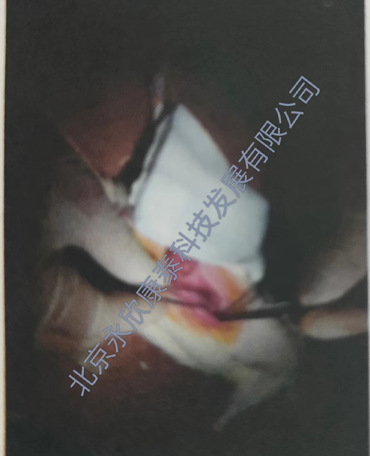 肾缺血再灌注损伤模型