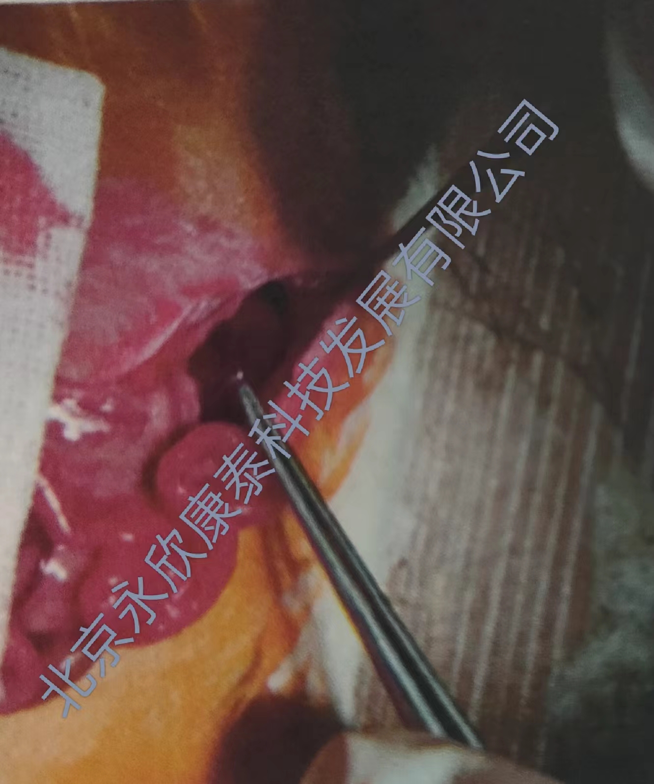 肾缺血再灌注损伤模型