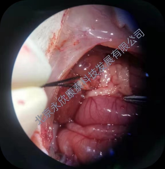 ��������խ��ѹģ��