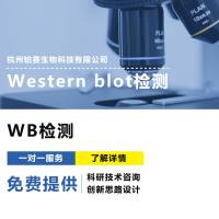 蛋白免疫印迹Western blot（WB）检测#Western Bloting#Western#蛋白质印迹法#免疫印迹试验