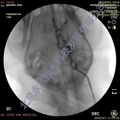 �ȸ�Ȯ�����ж���˨����ҩ����ͨģ��