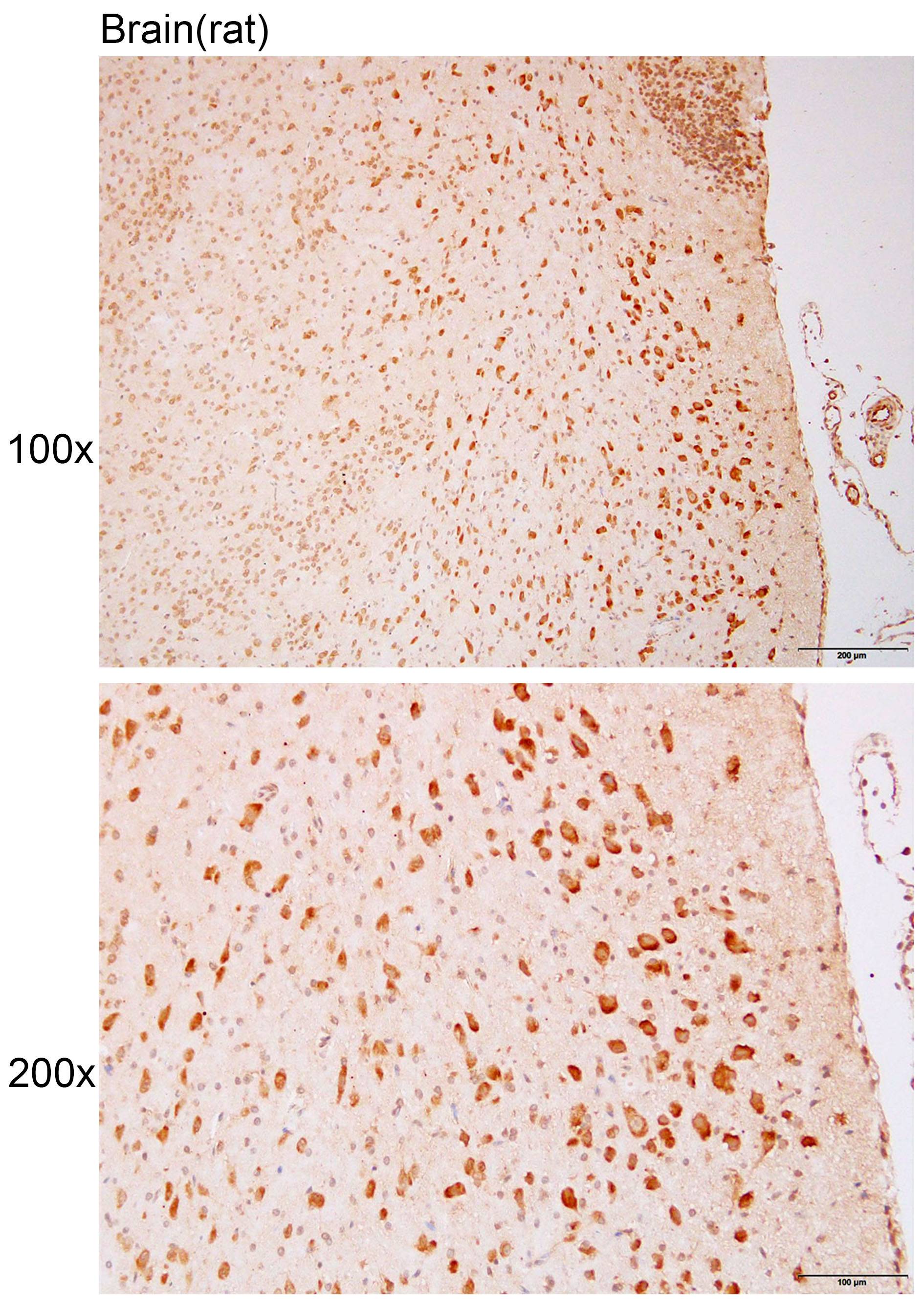 Anti-CBY1 Polyclonal Antibody
