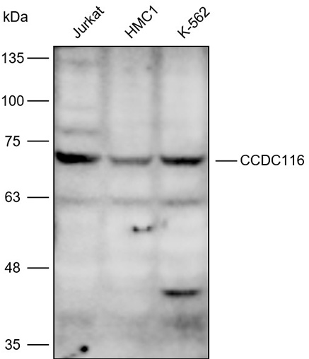 Anti-CCDC116 Polyclonal Antibo