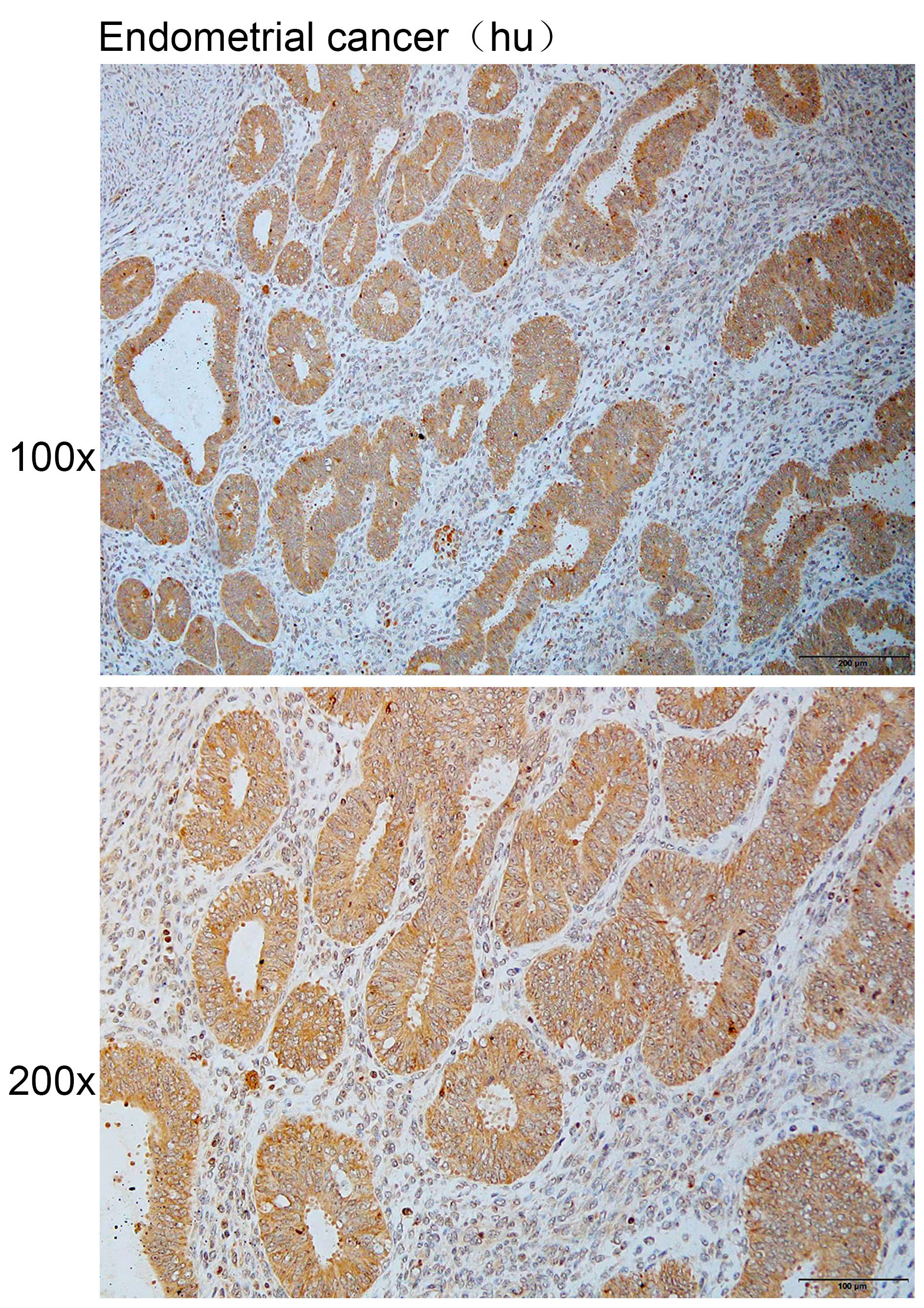 Anti-COL1A2 Polyclonal Antibod