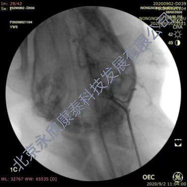 �ȸ�Ȯ�����ж���˨����ҩ����ͨģ��