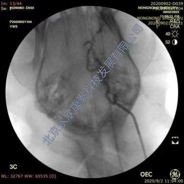 �ȸ�Ȯ�����ж���˨����ҩ����ͨģ��