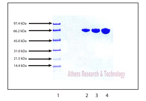 Athens Research人血浆转铁蛋白促销 Athens Research人血浆转铁蛋白促销