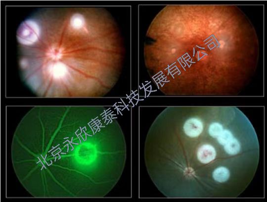脉络膜新生血管模型（激光光凝法）（CNV)