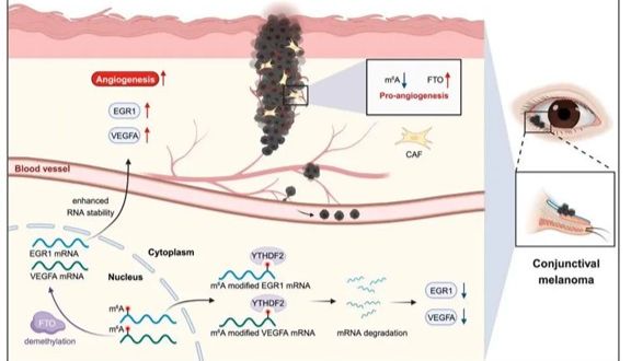 文章解读 | 九院贾仁兵团队揭示CAF促肿瘤血管新生的RNA表观调控机制