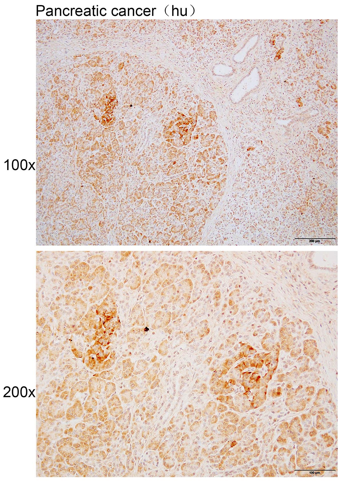 Anti-CCDC14 Polyclonal Antibod