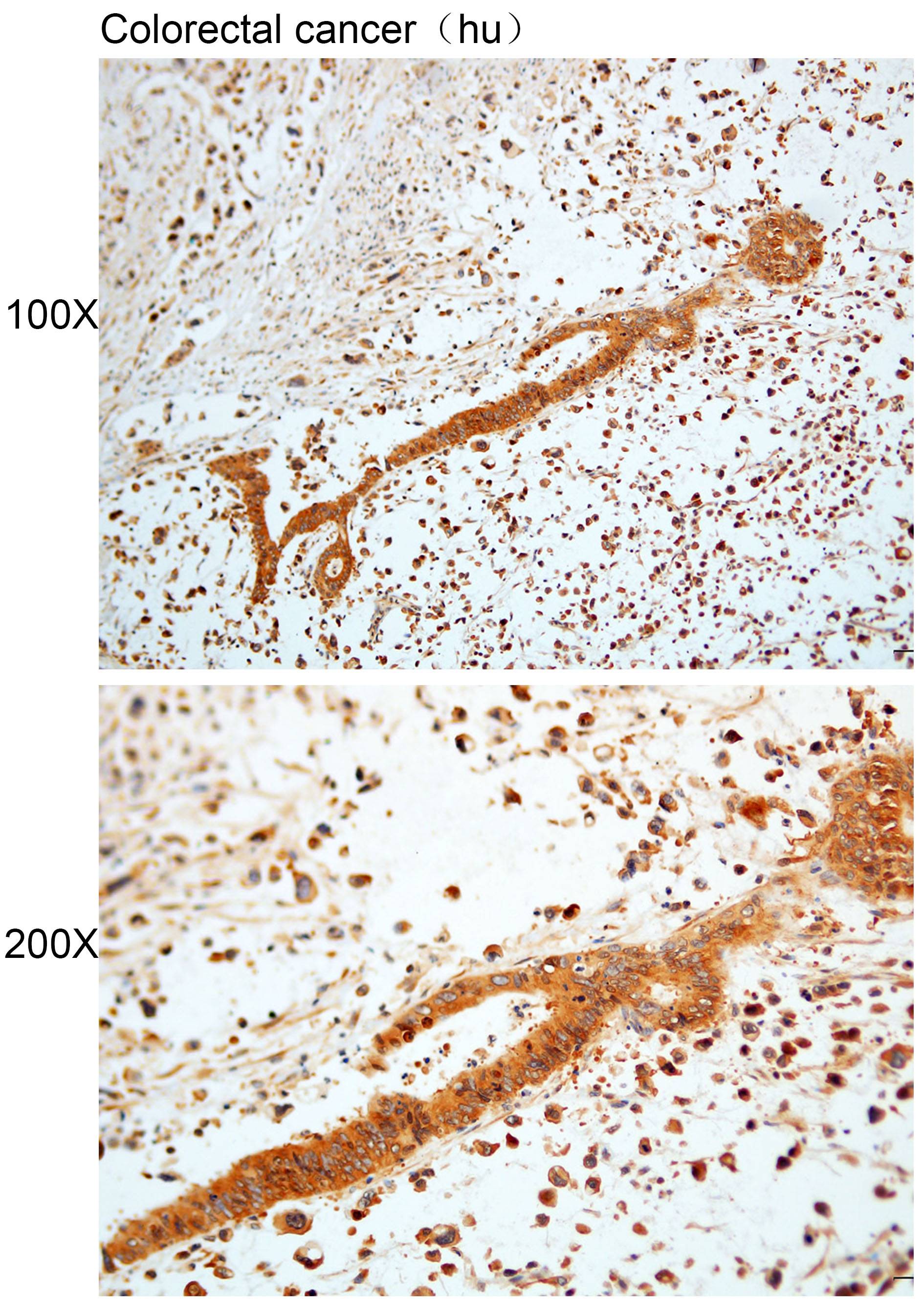Anti-CCDC66 Polyclonal Antibod